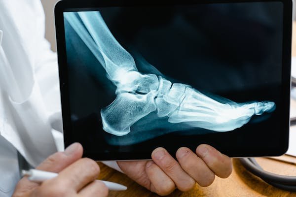 Découvrez les avantages des nouvelles solutions orthopédiques